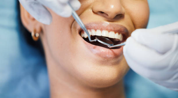 Best Emergency Dentist for Lost Fillings or Crowns in Quanah, TX