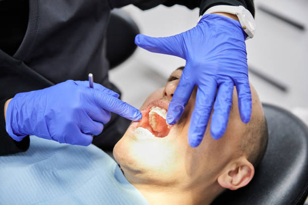 Best Emergency Dentist for Knocked-Out Tooth in Quanah, TX