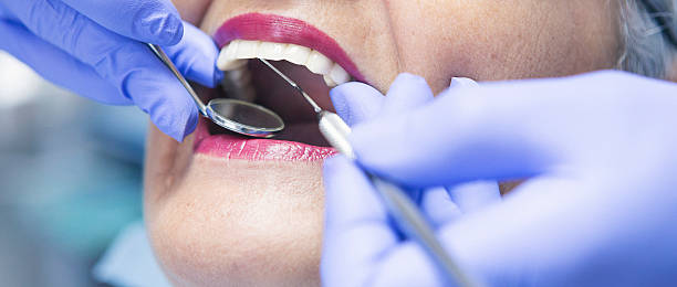 Best Emergency Dentist for Knocked-Out Tooth in Quanah, TX